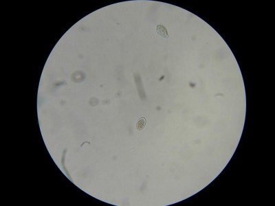 Phytophthora_infestans(patata)3.JPG