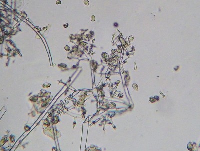 peronospora vite - sporangi.jpg