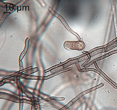 CLADOSPORIUM_IRIDIS_foglie_conidi_54x12-micron.JPG