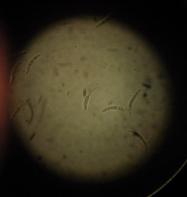 cilindrosporiosi ciliegio - conidia.JPG