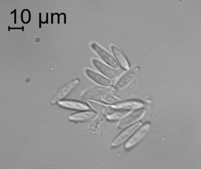 Ivrea -COLLETOTRICHUM_olivo_pda_alesandro_20-micron-2.JPG