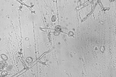 peronospora-vite-sporangi.jpg