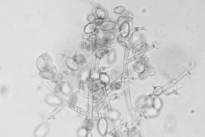 peronospora-ramficazionei-e-sporangi.jpg