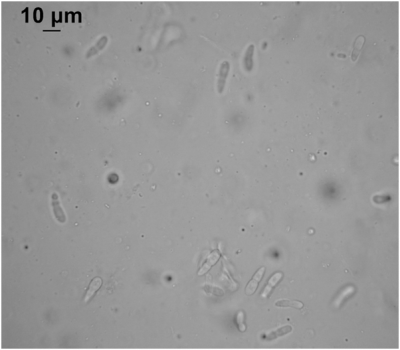 ticchiolatura rosa conidi.png