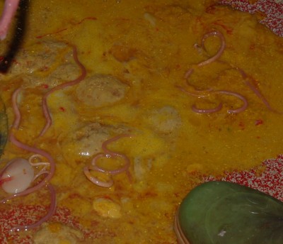 Parassiti intestinali.jpg