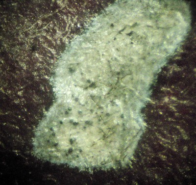 rincospermo (acervula).jpg (265.26 KiB) Osservato 661 volte rincospermo (acervula).jpg