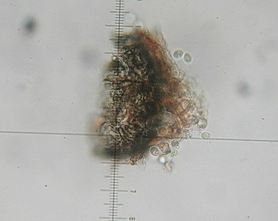 black rot picnidio-conidi-.JPG (95.41 KiB) Osservato 1020 volte black rot picnidio-conidi-.JPG